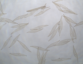 diatomeen_pleurosigma_angulatum_2_bearb_000